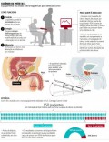 Scanner identifica câncer de próstata sem exame
