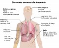 Leucemia: cientistas dos EUA descobrem nova esperança